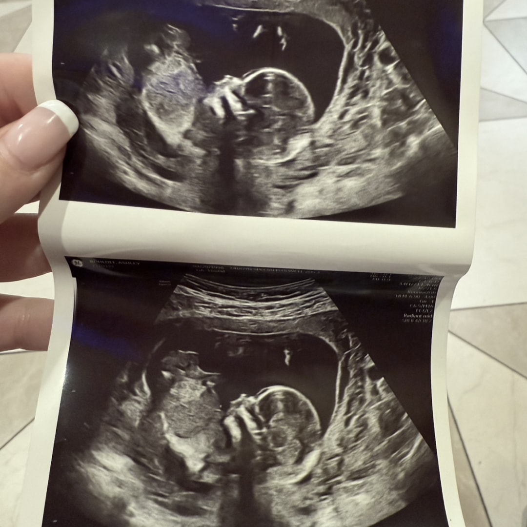 Photo shared by Ashley for their Babylist baby registry.