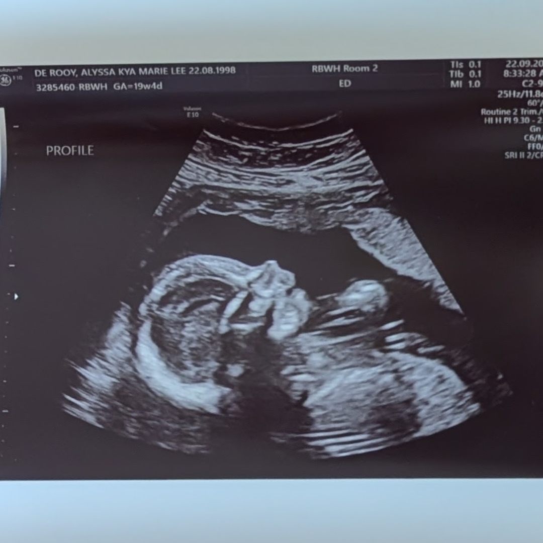 Photo shared by Alyssa for their Babylist baby registry.