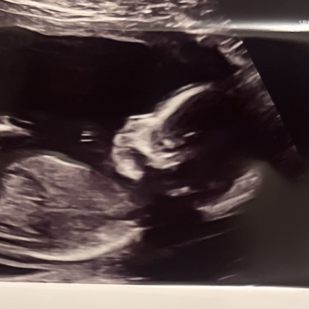 Photo shared by Jhocelline for their Babylist baby registry.