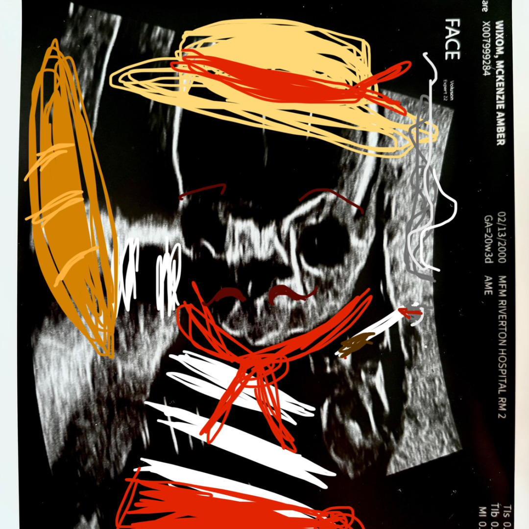 Photo shared by McKenzie for their Babylist baby registry.