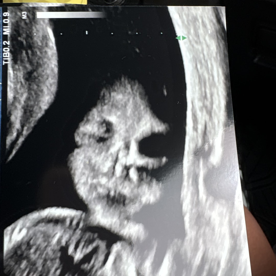 Photo shared by Daphne for their Babylist baby registry.