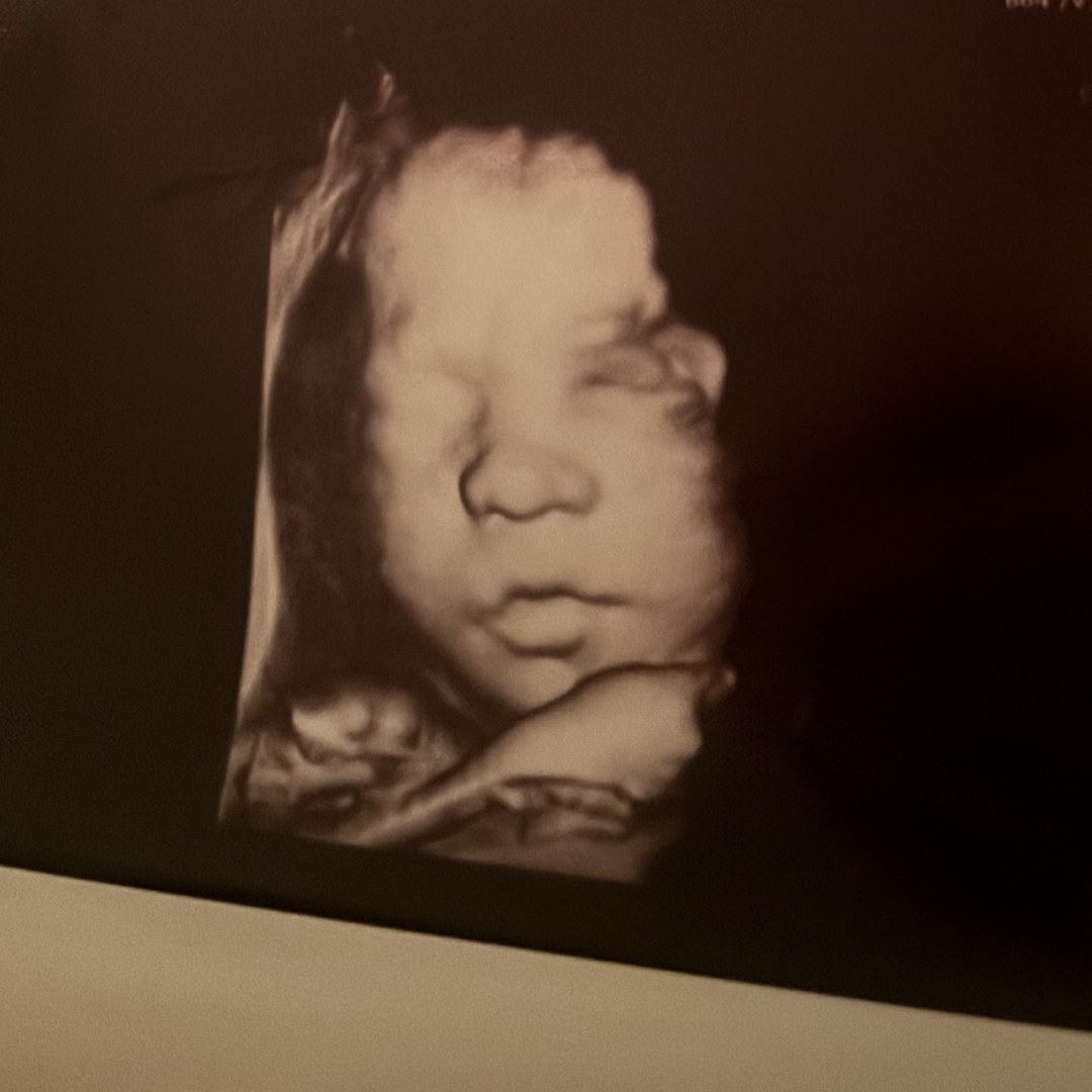 Photo shared by Cassie for their Babylist baby registry.