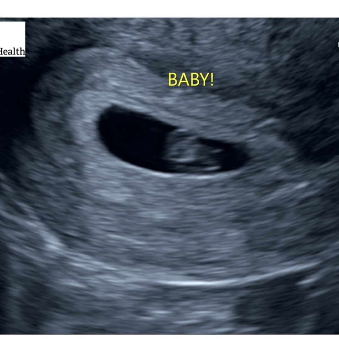 Photo shared by Hayley for their Babylist baby registry.