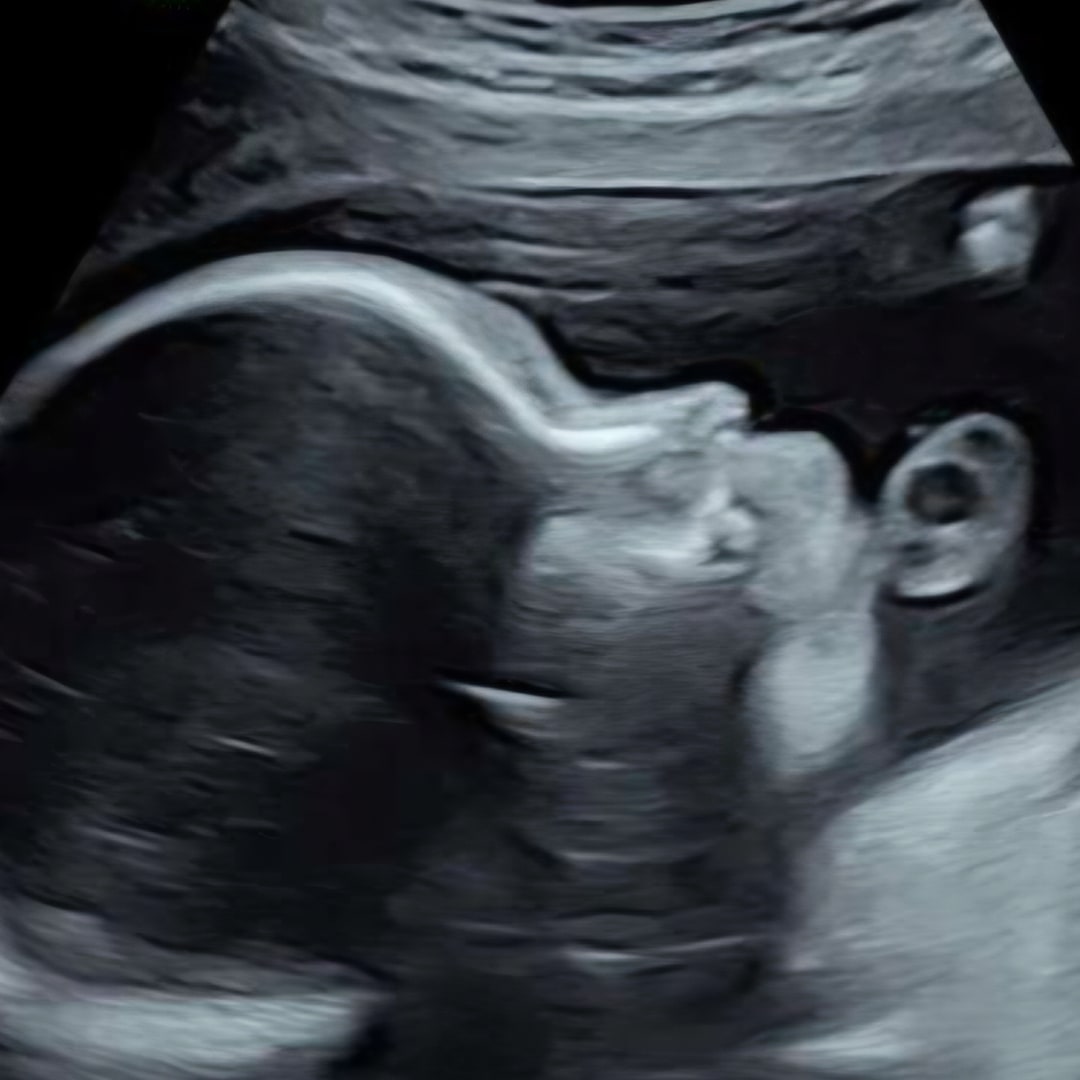 Photo shared by Sylvia for their Babylist baby registry.