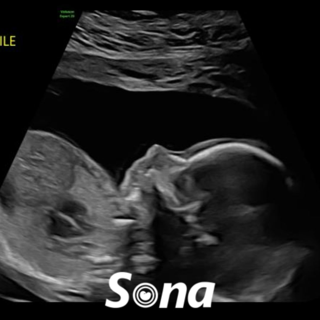 Photo shared by Anna Hogan for their Babylist baby registry.