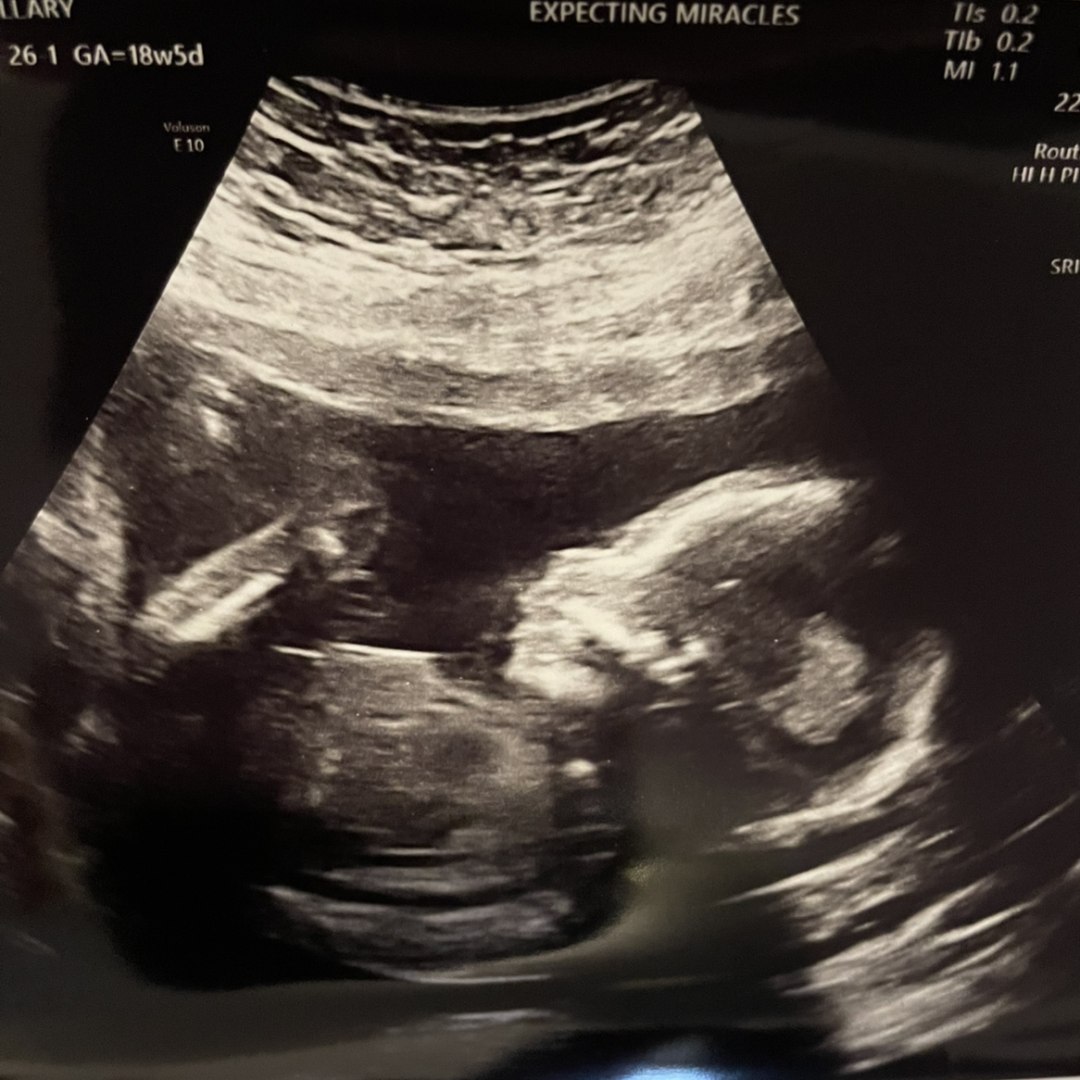 Photo shared by Hilary for their Babylist baby registry.