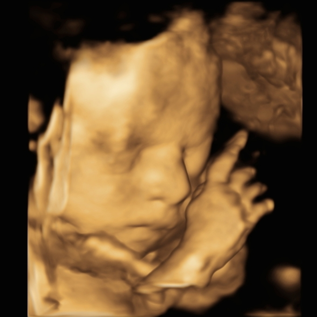 Photo shared by Desiree for their Babylist baby registry.