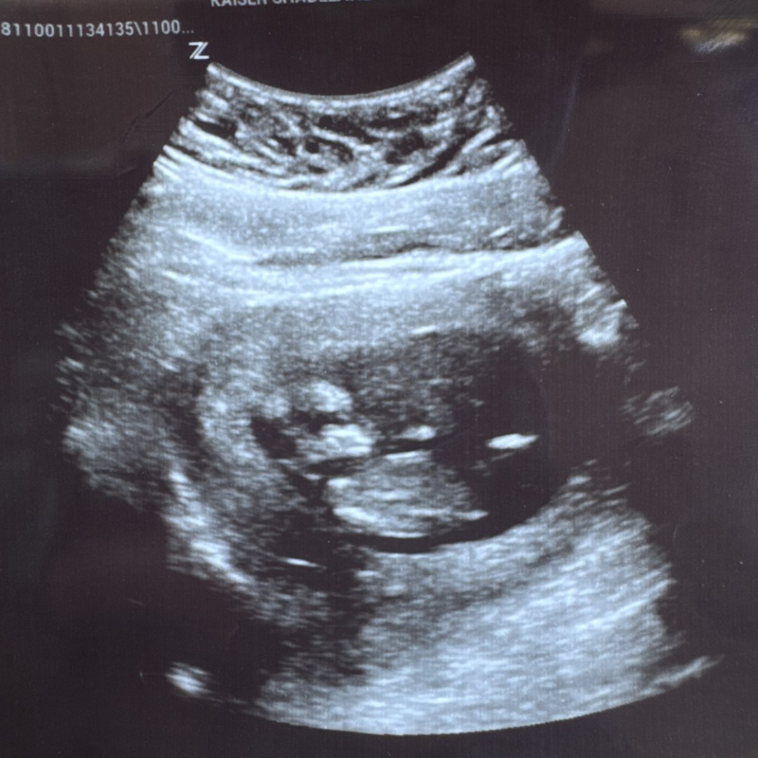 Photo shared by Sofia for their Babylist baby registry.