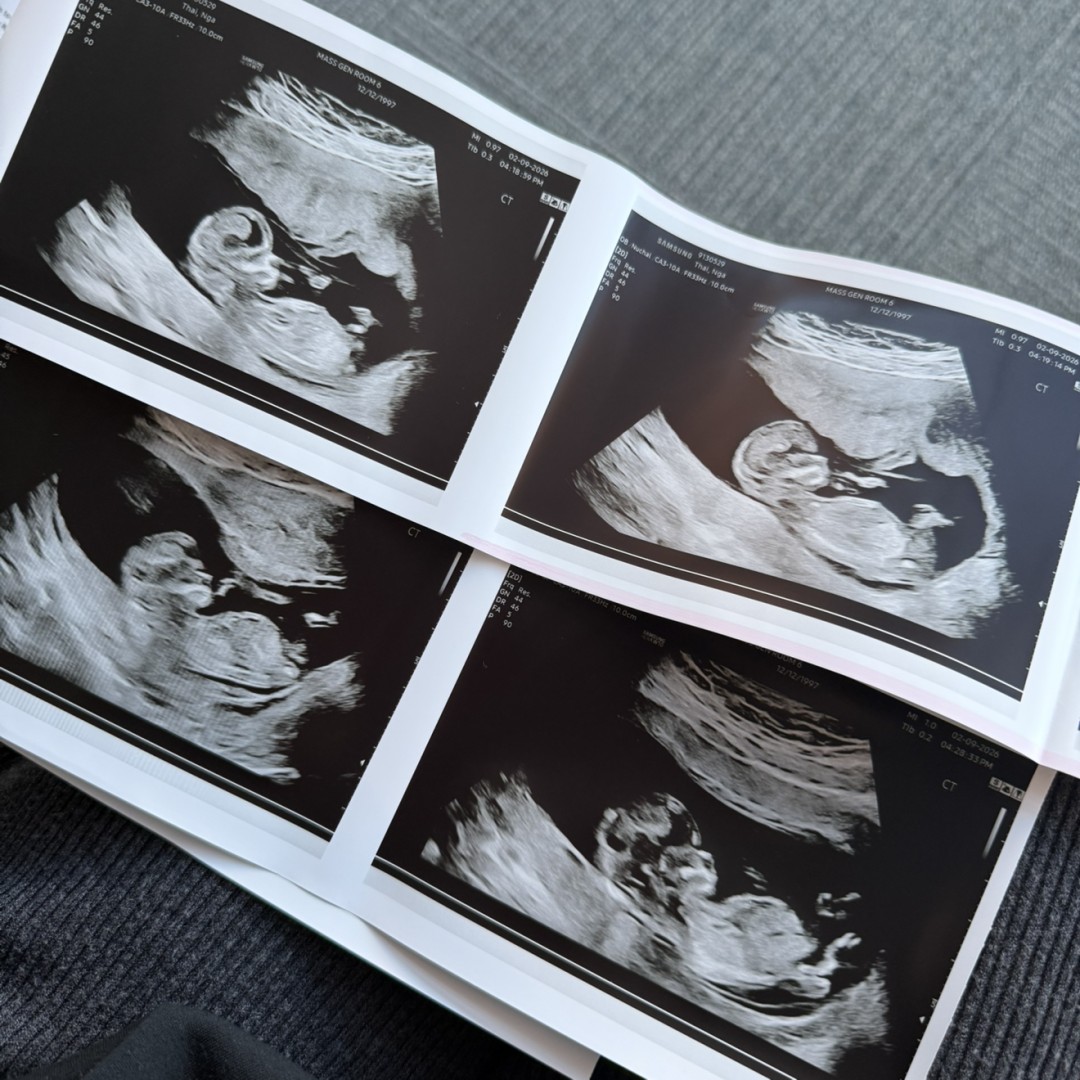 Photo shared by Nga for their Babylist baby registry.
