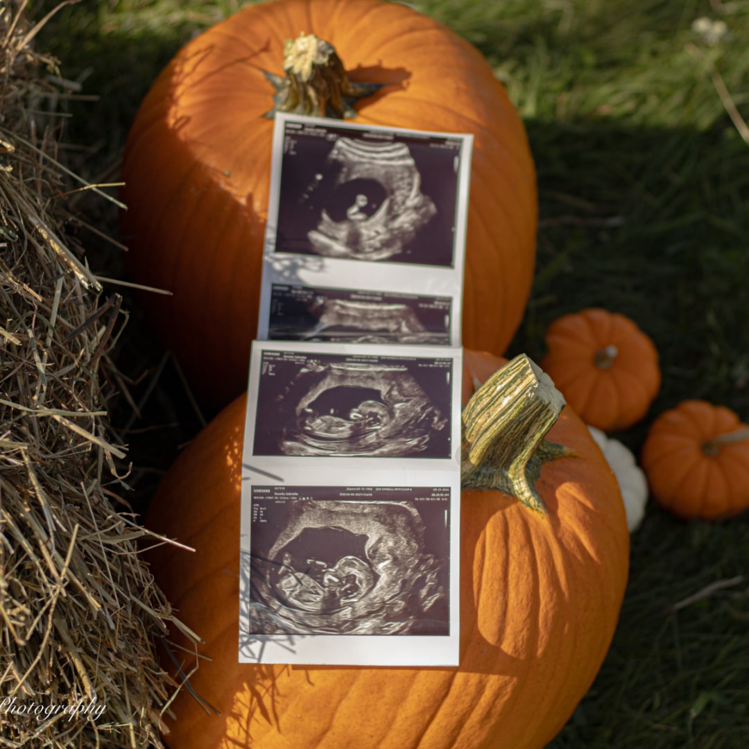 Photo shared by Gabrielle for their Babylist baby registry.