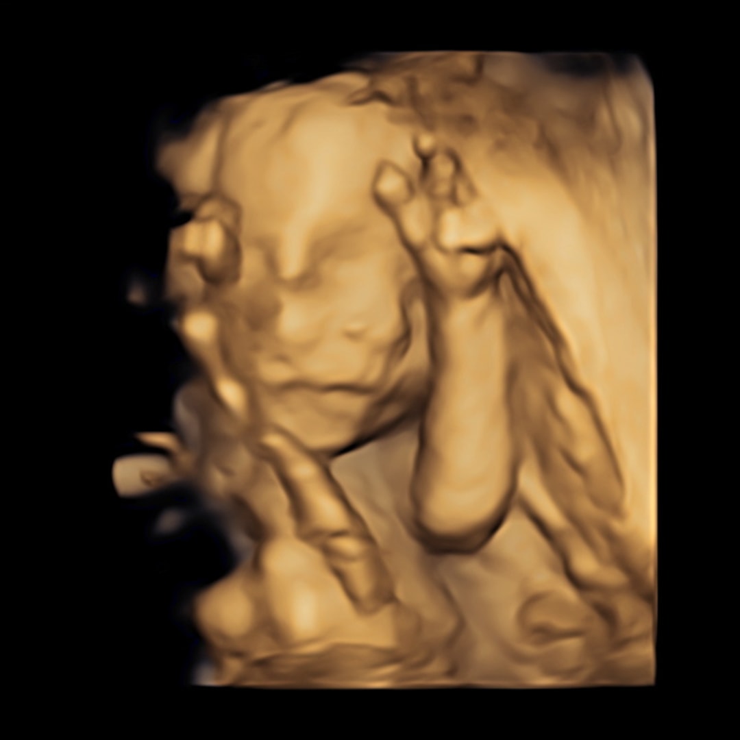 Photo shared by Jania & for their Babylist baby registry.