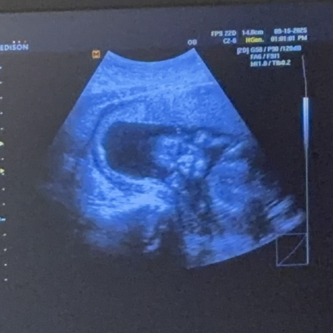 Photo shared by Allison for their Babylist baby registry.