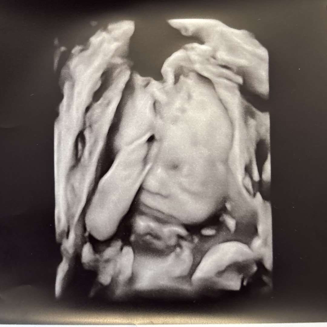 Photo shared by Megan for their Babylist baby registry.