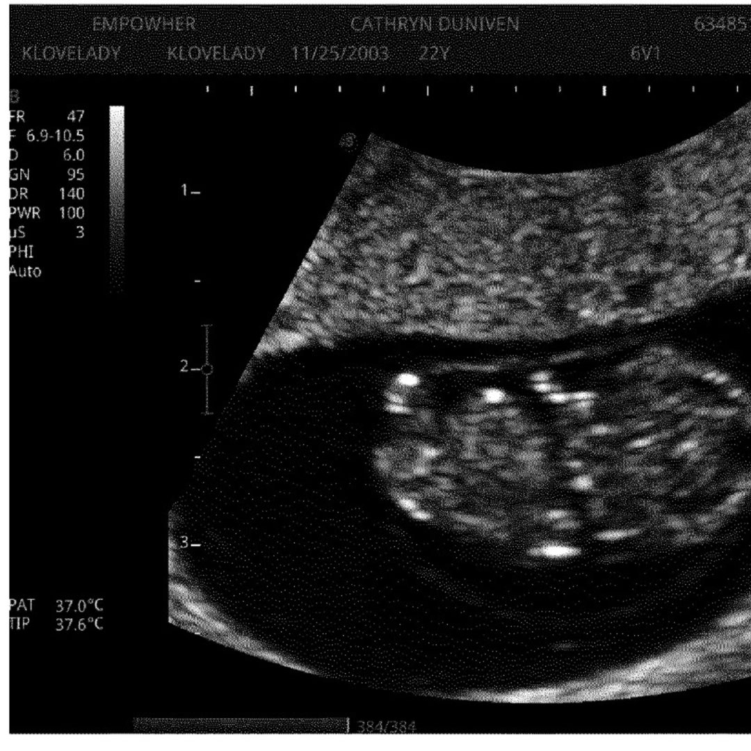 Photo shared by Cathryn for their Babylist baby registry.