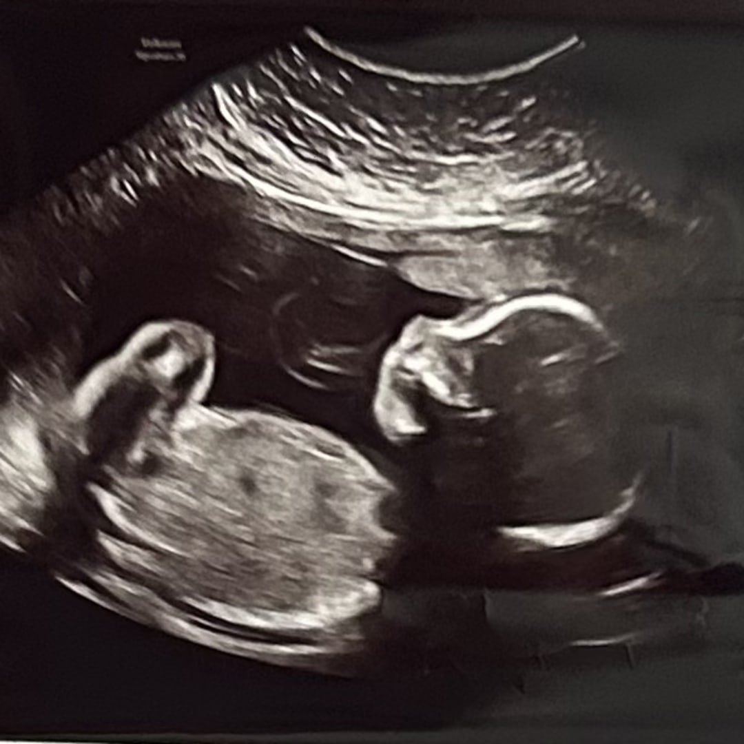 Photo shared by Shannon for their Babylist baby registry.