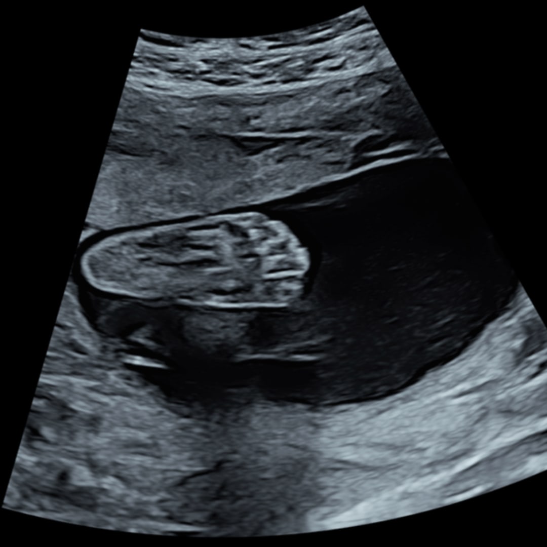 Photo shared by Abigail for their Babylist baby registry.