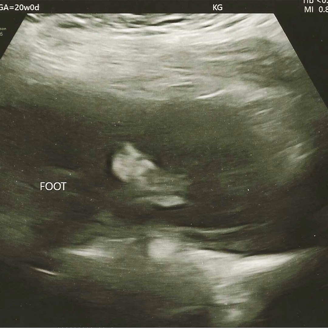 Photo shared by Brianna for their Babylist baby registry.