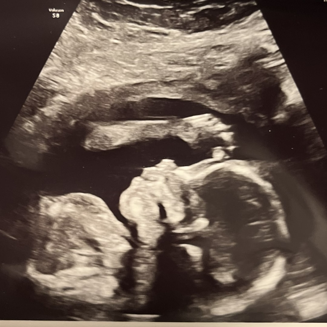 Photo shared by Heidi for their Babylist baby registry.