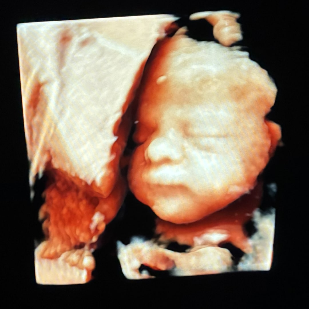 Photo shared by Christian for their Babylist baby registry.