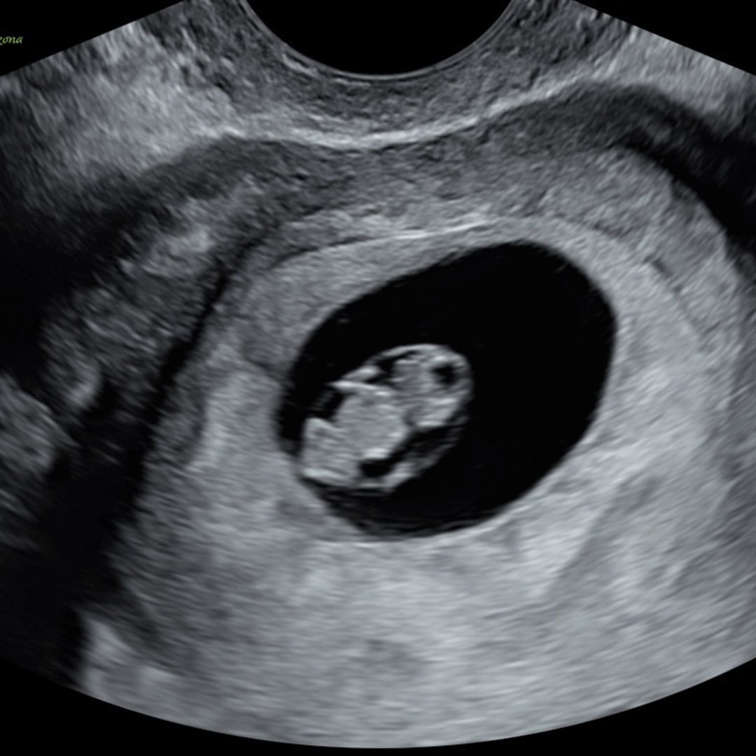 Photo shared by Maria for their Babylist baby registry.