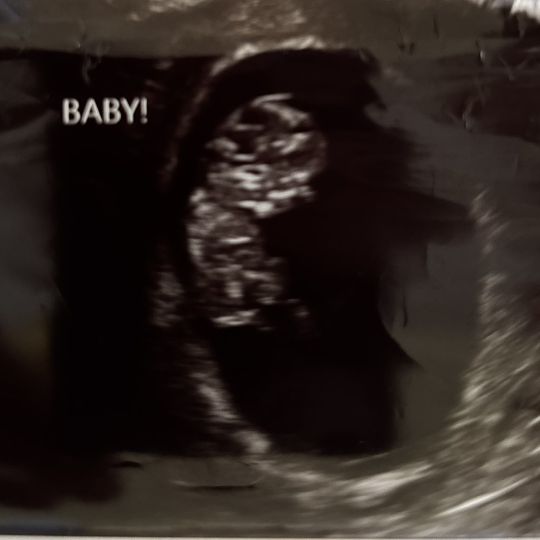 Photo shared by Jessica for their Babylist baby registry.