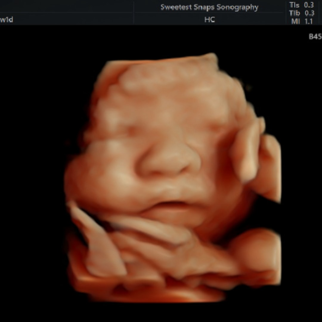 Photo shared by Brianna for their Babylist baby registry.
