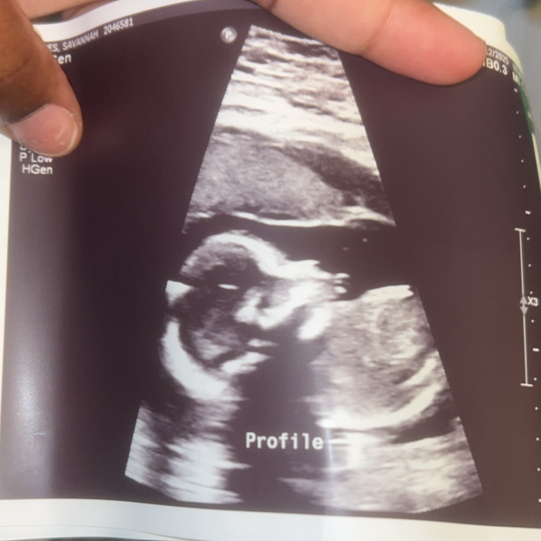 Photo shared by Savannah for their Babylist baby registry.