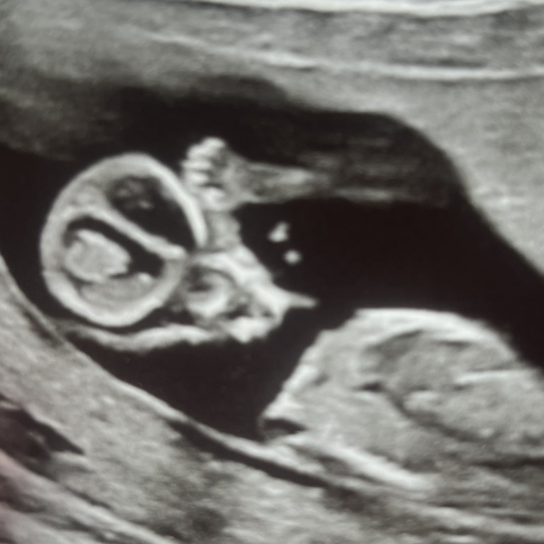 Photo shared by Madisonn for their Babylist baby registry.