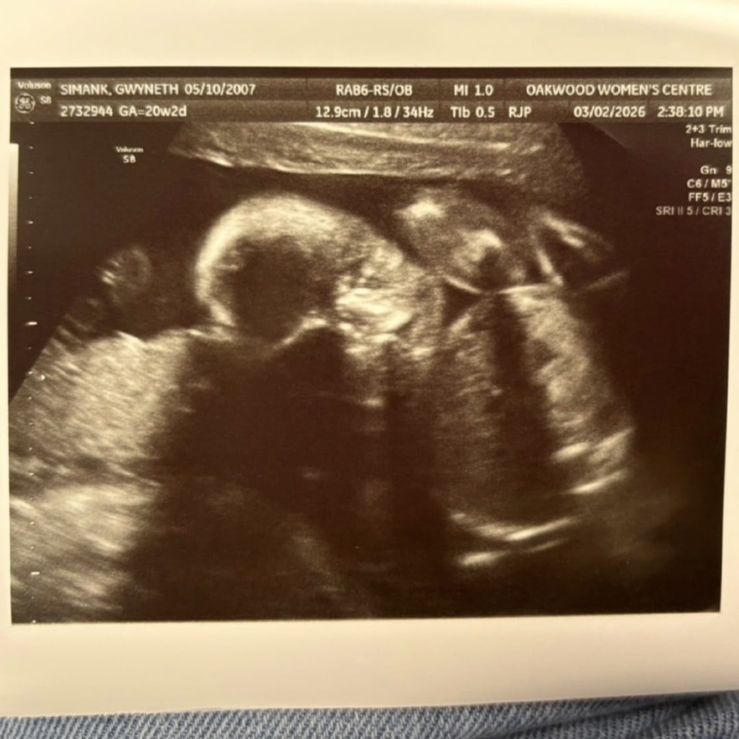 Photo shared by Gwyn for their Babylist baby registry.