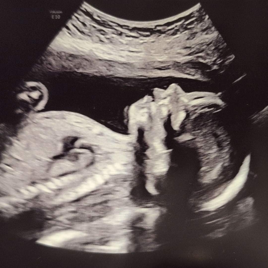 Photo shared by Wendy for their Babylist baby registry.