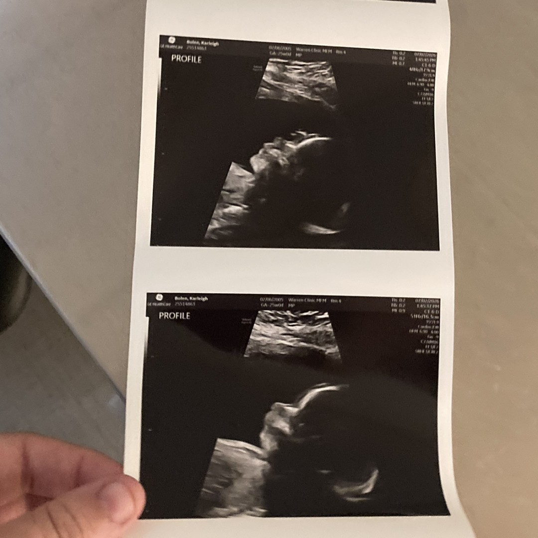 Photo shared by Karleigh for their Babylist baby registry.