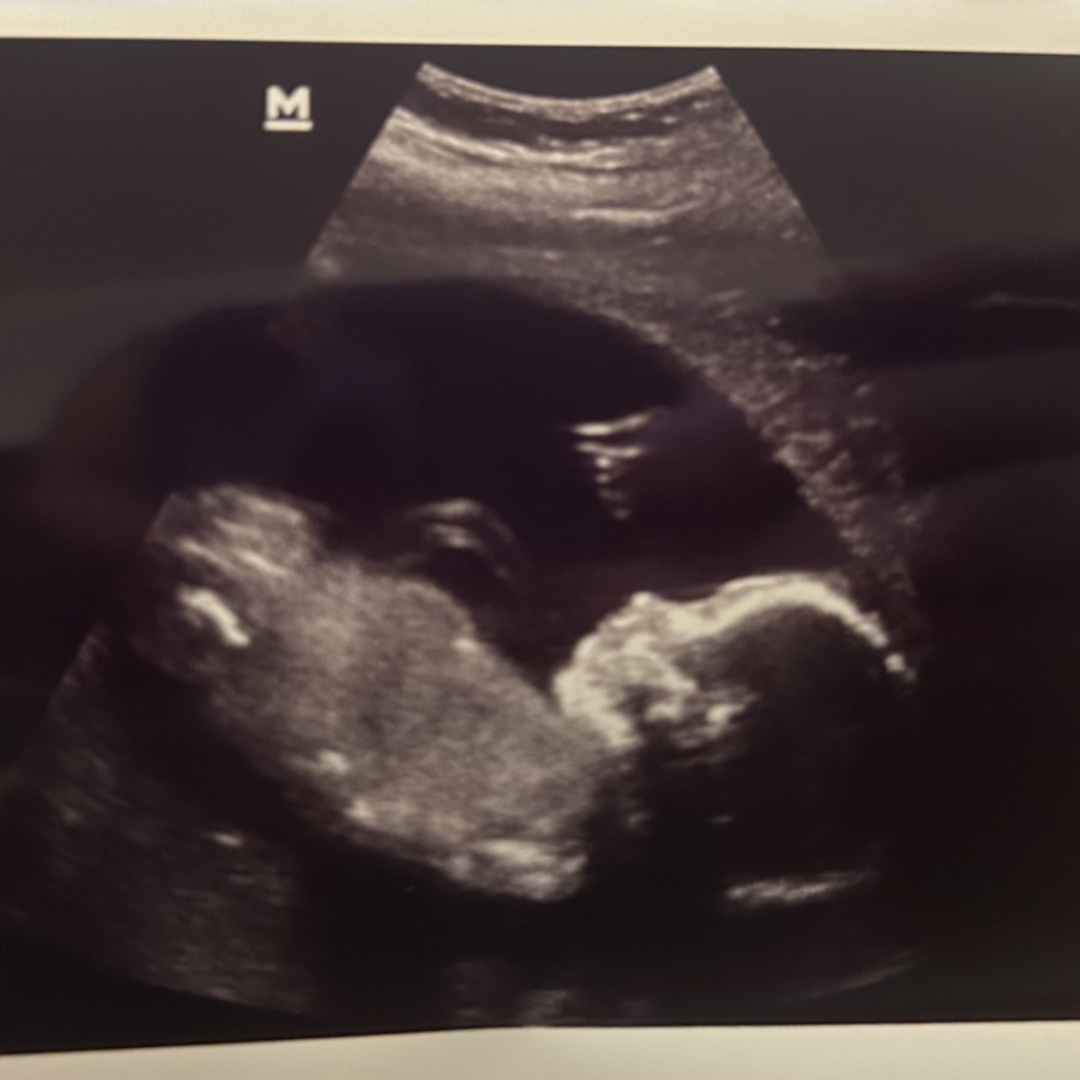 Photo shared by Rachel for their Babylist baby registry.