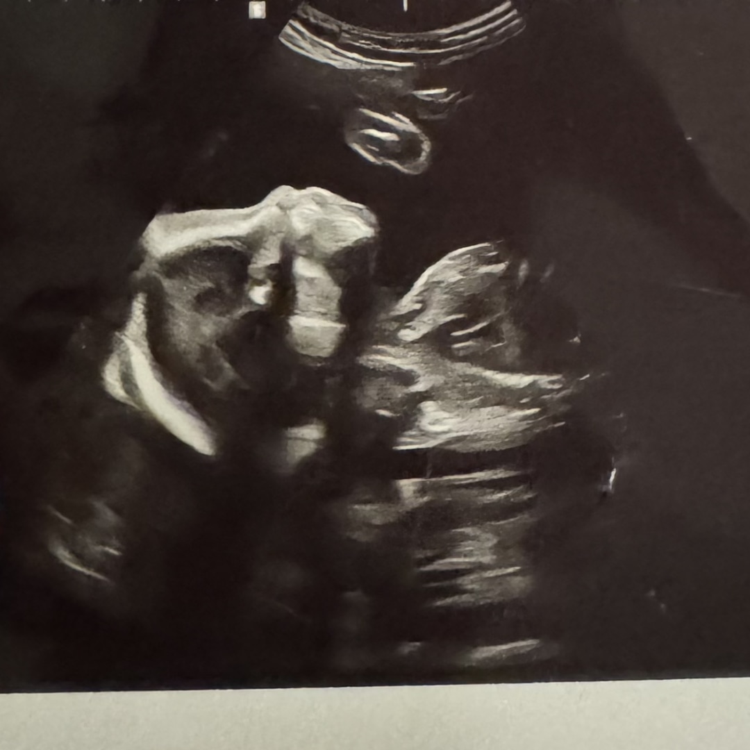 Photo shared by Karissa for their Babylist baby registry.