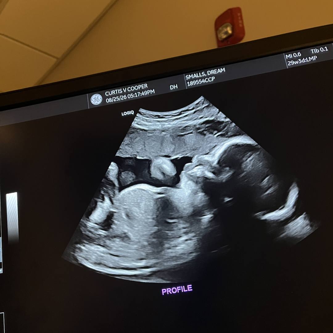 Photo shared by Dream for their Babylist baby registry.
