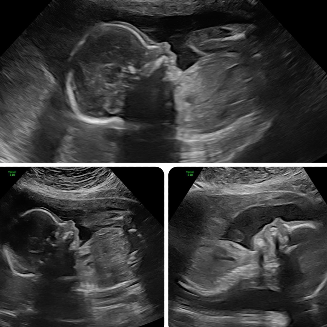 Photo shared by Rebecca for their Babylist baby registry.