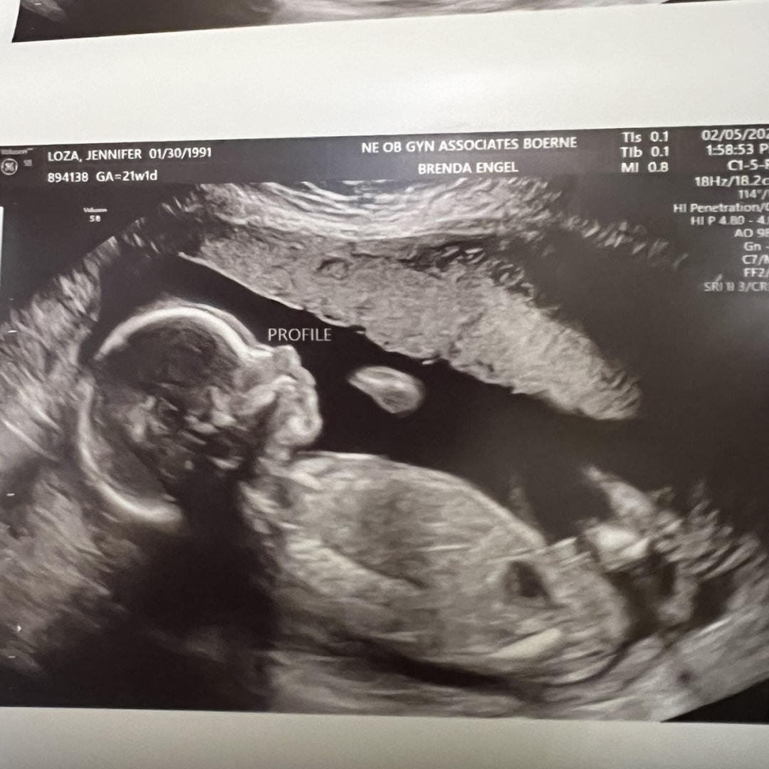 Photo shared by Jenny for their Babylist baby registry.