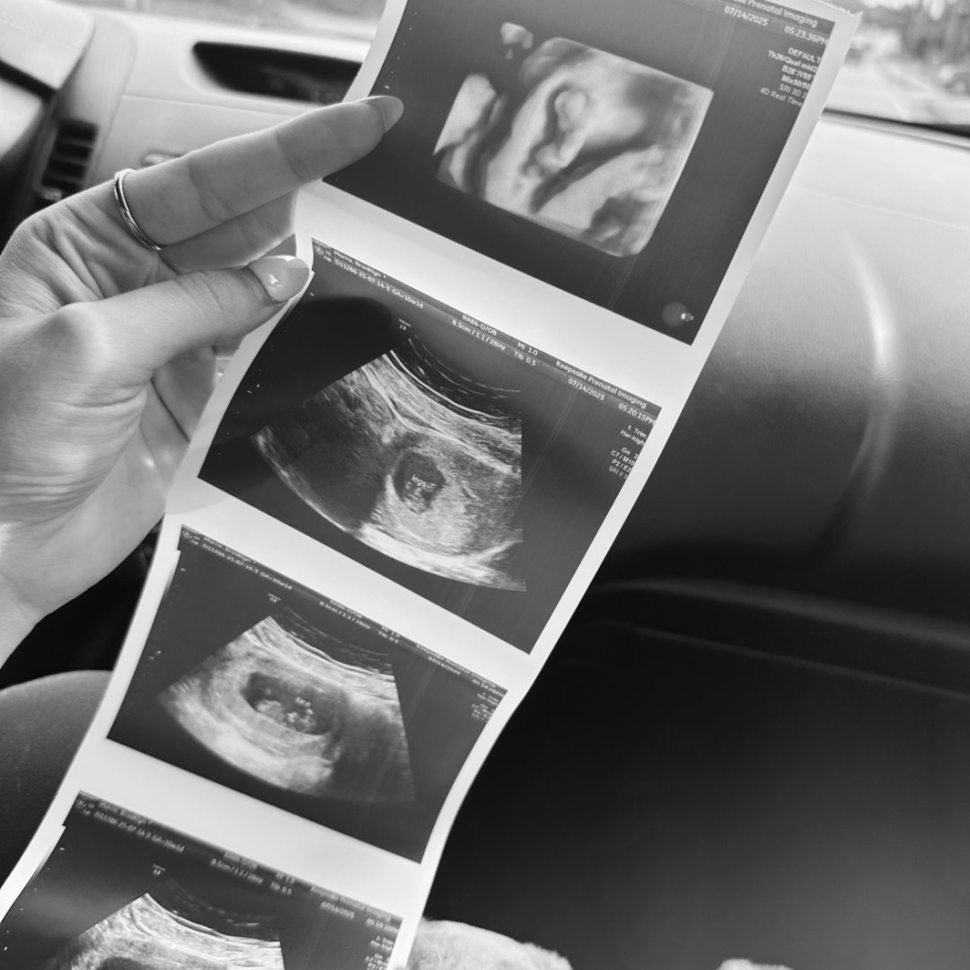 Photo shared by Brooklyn for their Babylist baby registry.