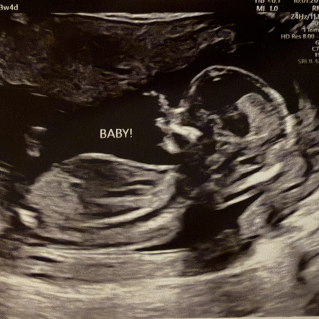 Photo shared by Kaylee for their Babylist baby registry.