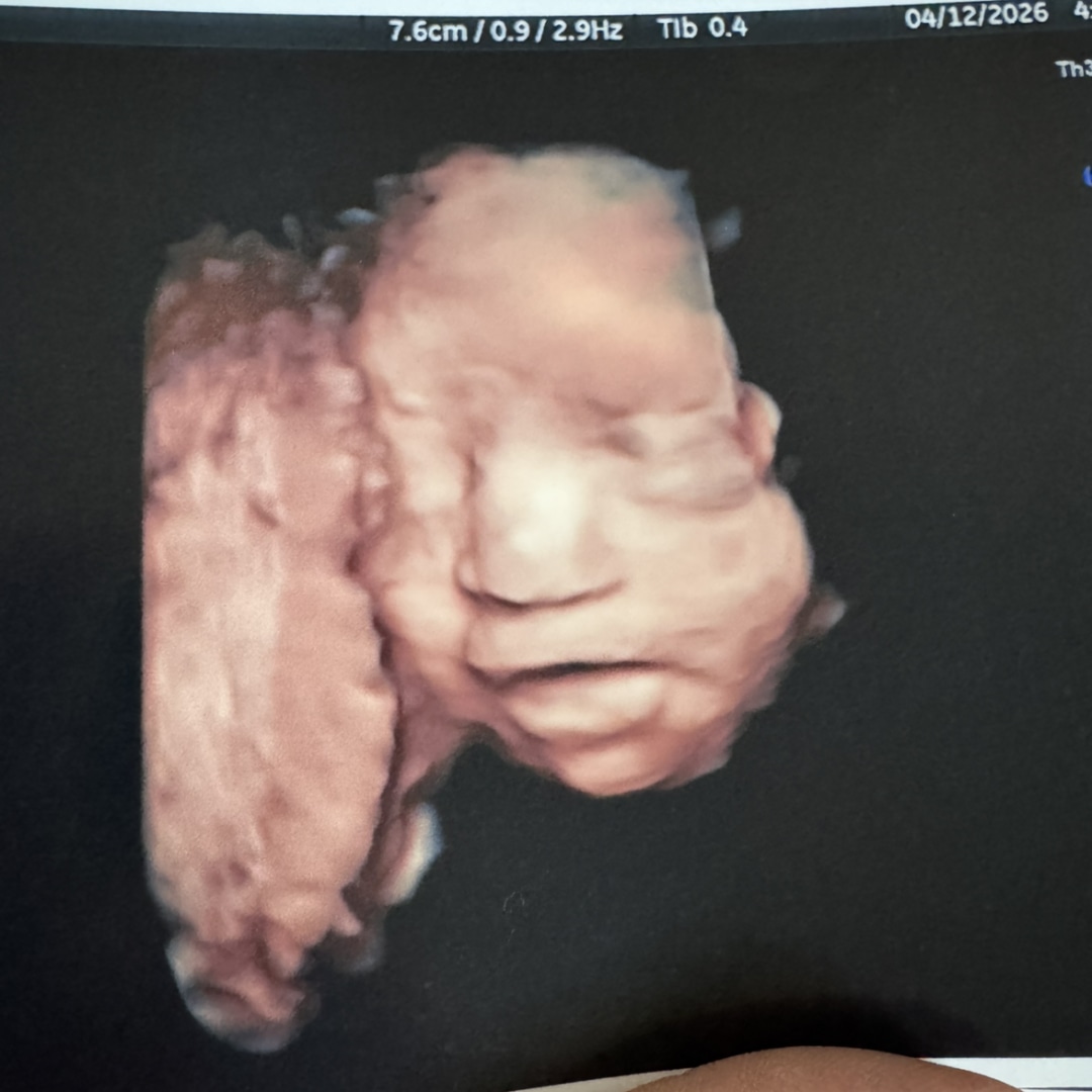 Photo shared by Nancy for their Babylist baby registry.