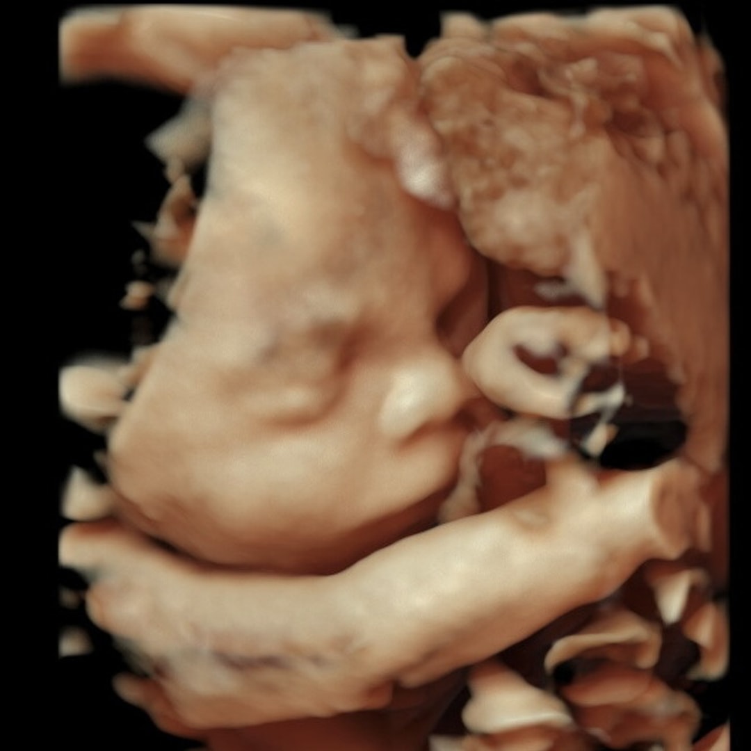 Photo shared by Emma for their Babylist baby registry.