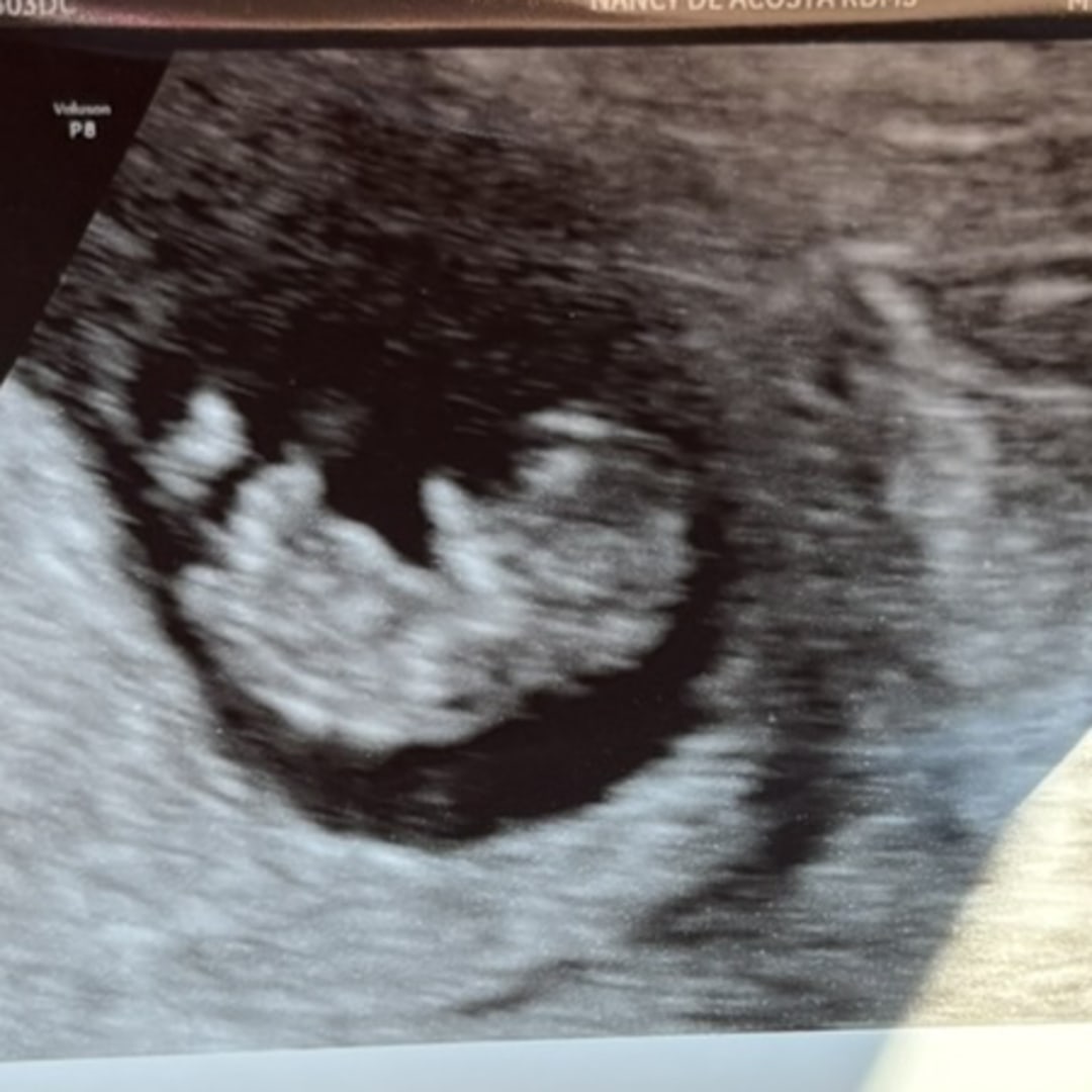 Photo shared by Denisse for their Babylist baby registry.