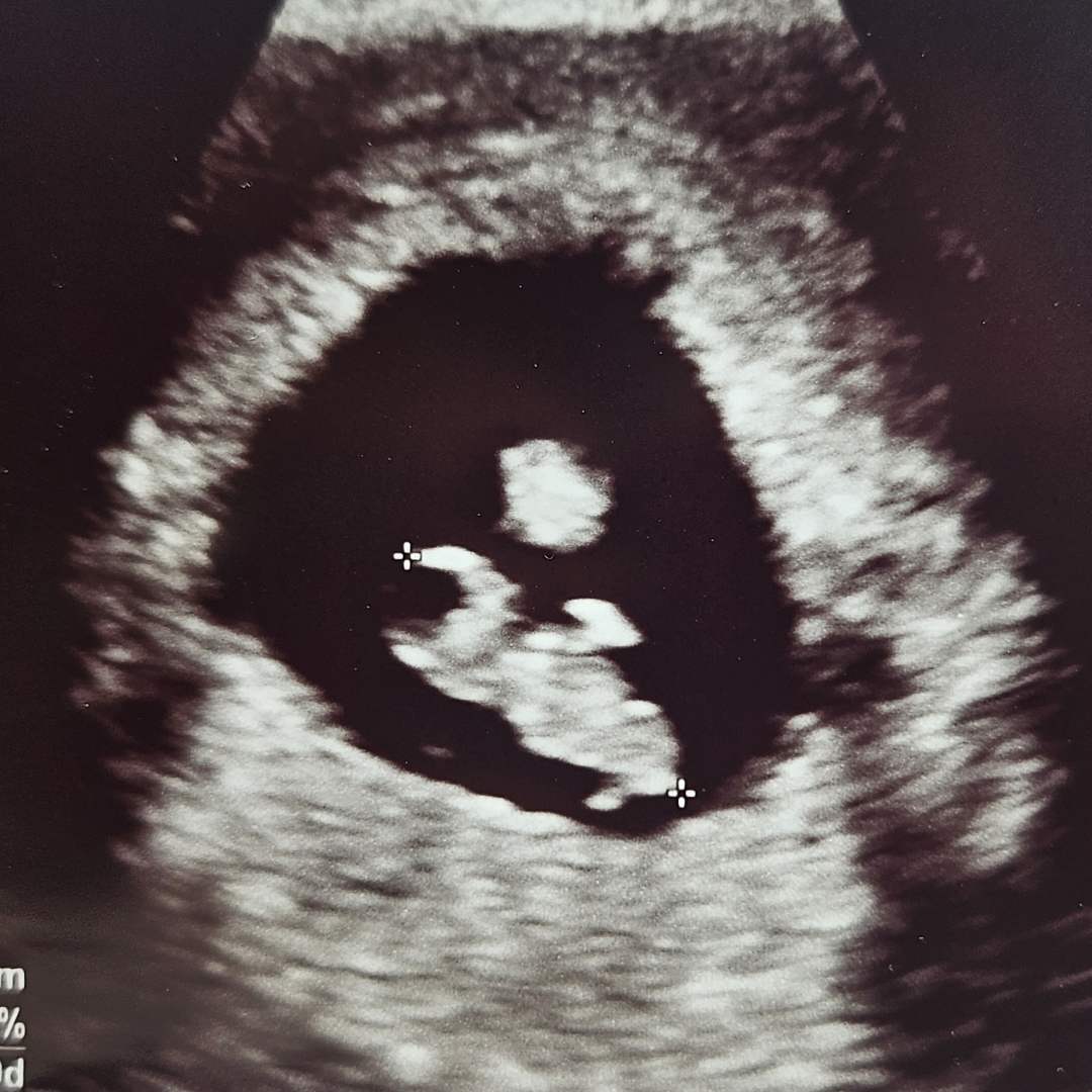 Photo shared by Maria for their Babylist baby registry.