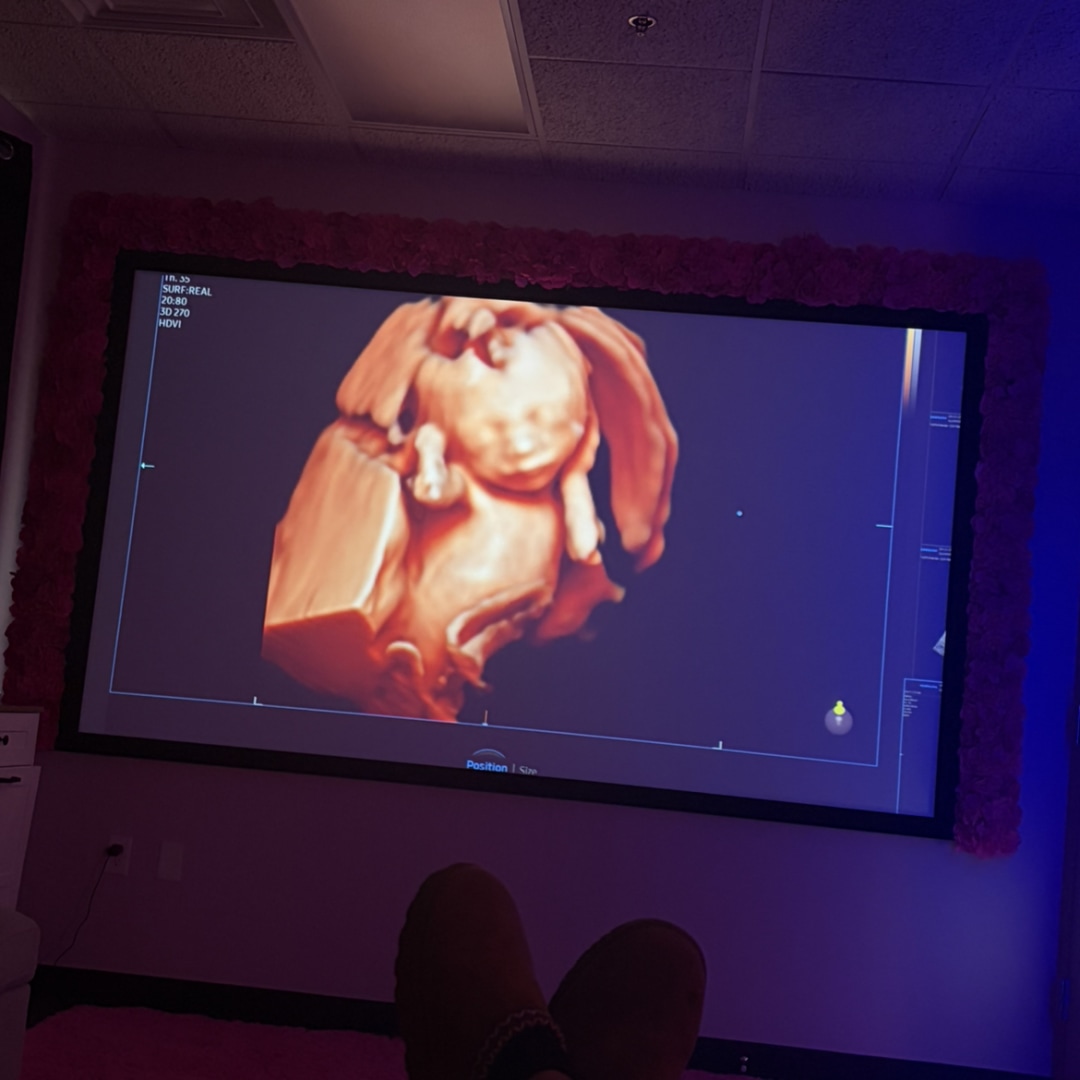 Photo shared by Ani for their Babylist baby registry.