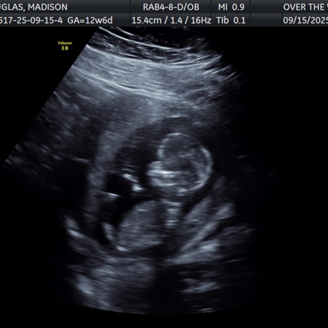 Photo shared by Maddie for their Babylist baby registry.