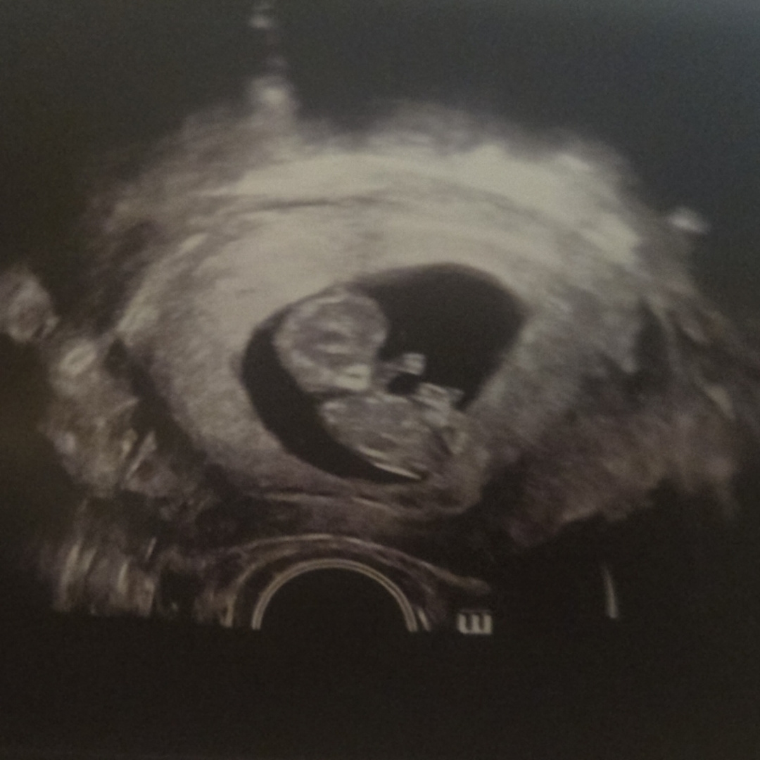 Photo shared by Katy for their Babylist baby registry.