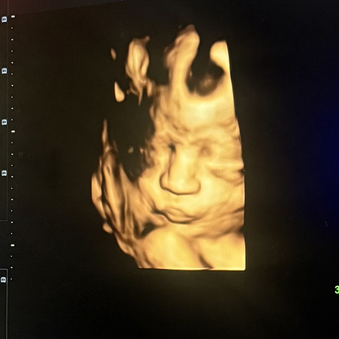 Photo shared by Anisai for their Babylist baby registry.