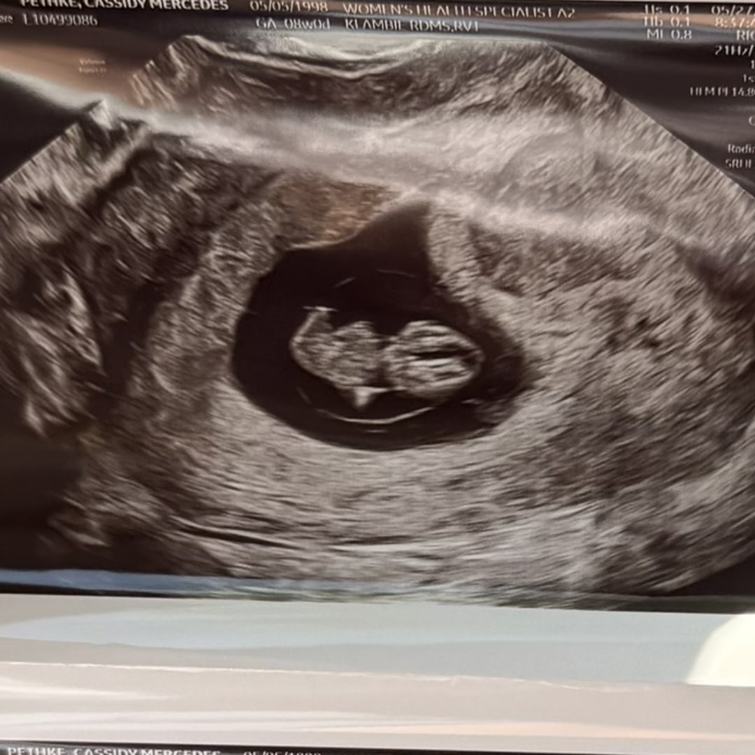 Photo shared by Cassidy for their Babylist baby registry.