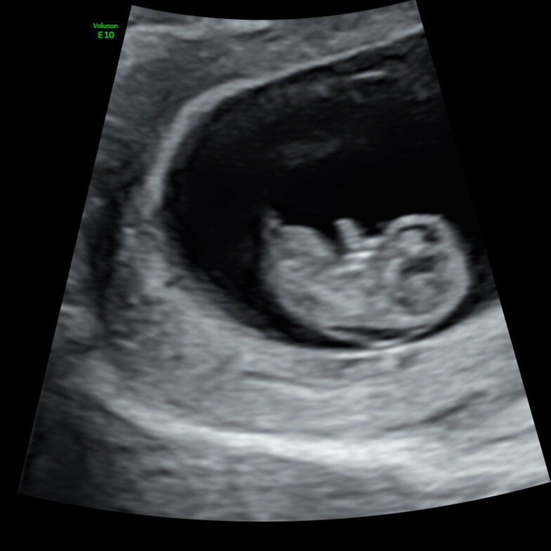 Photo shared by Sidney for their Babylist baby registry.