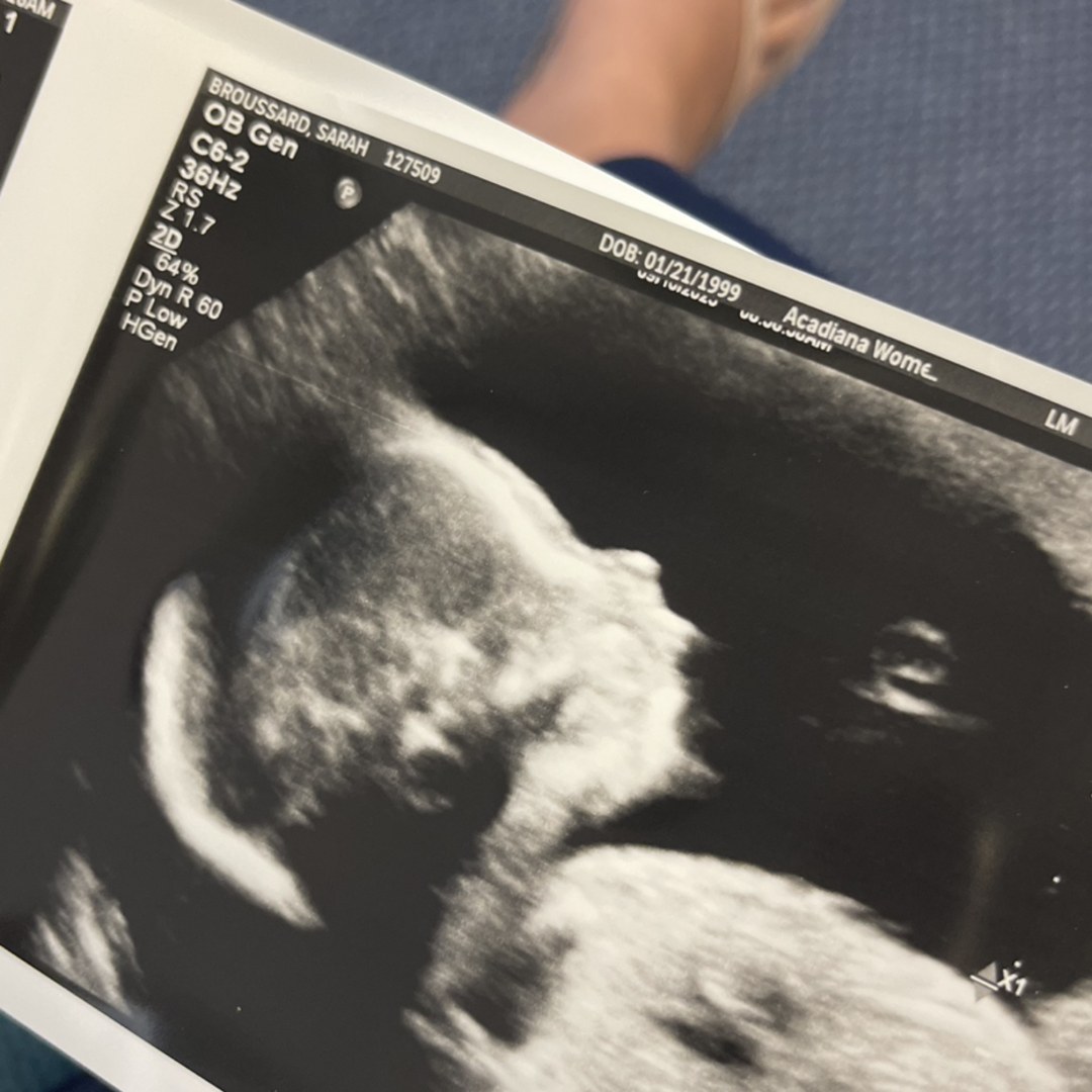 Photo shared by Sarah for their Babylist baby registry.