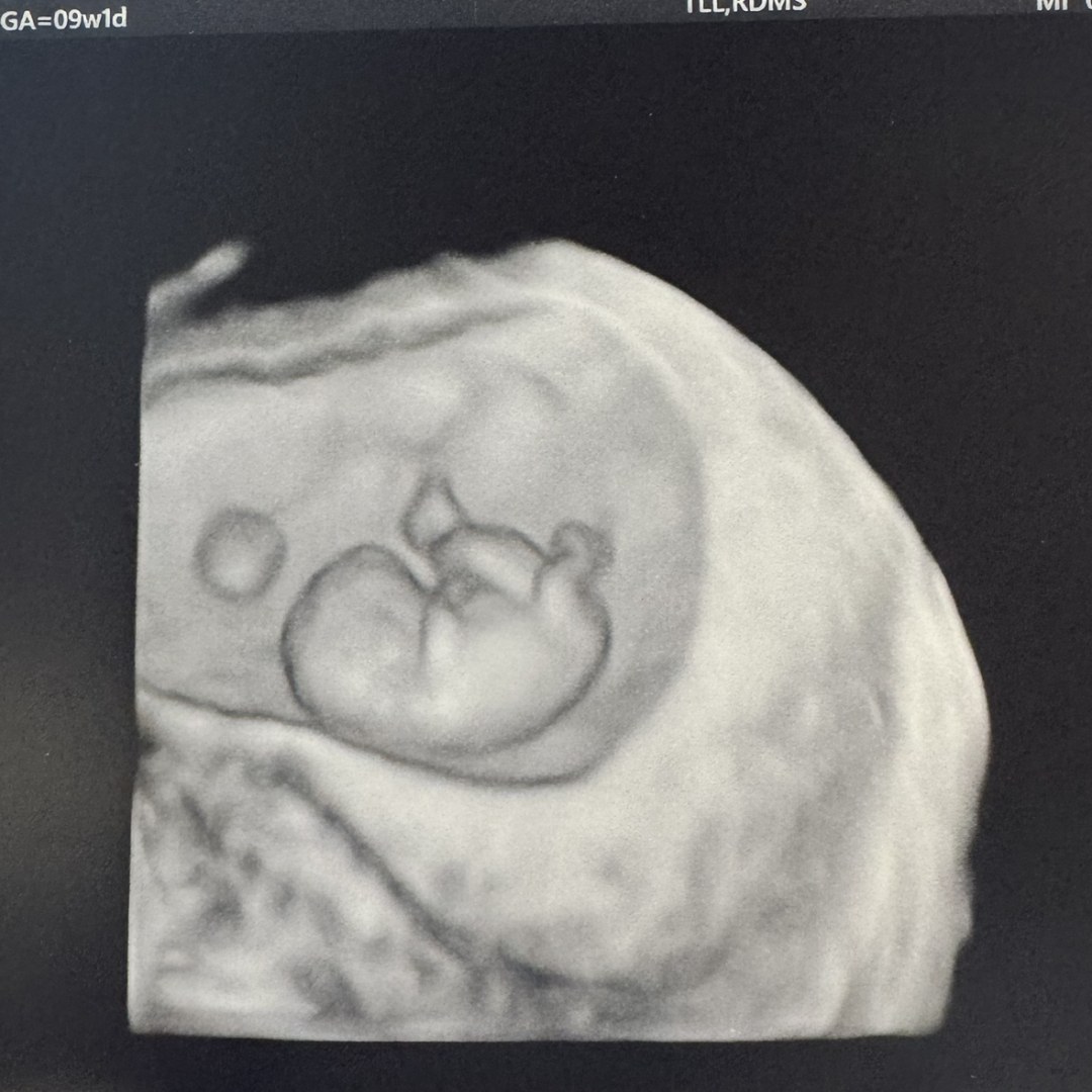 Photo shared by Kaelyn for their Babylist baby registry.